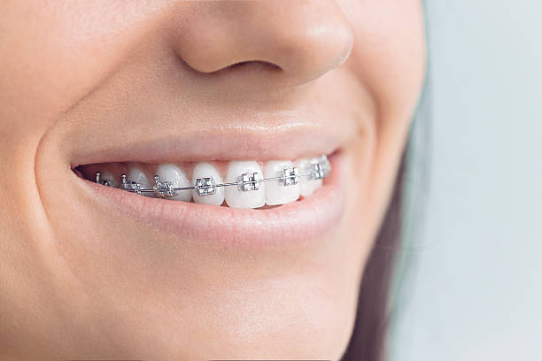 Best Veneers and Lumineers  in Nanticoke, PA